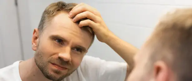 Stem Cell Therapy for Hair Loss