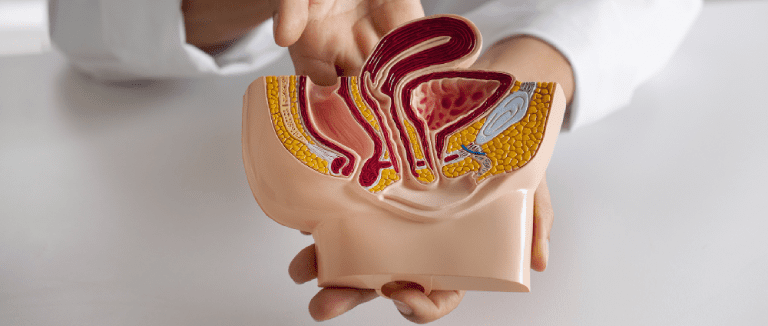 Bladder Cancer: 5 Powerful Health Insights 4 Bladder Cancer