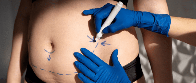 Plastic Surgery: The Positive Change 4 Plastic surgery