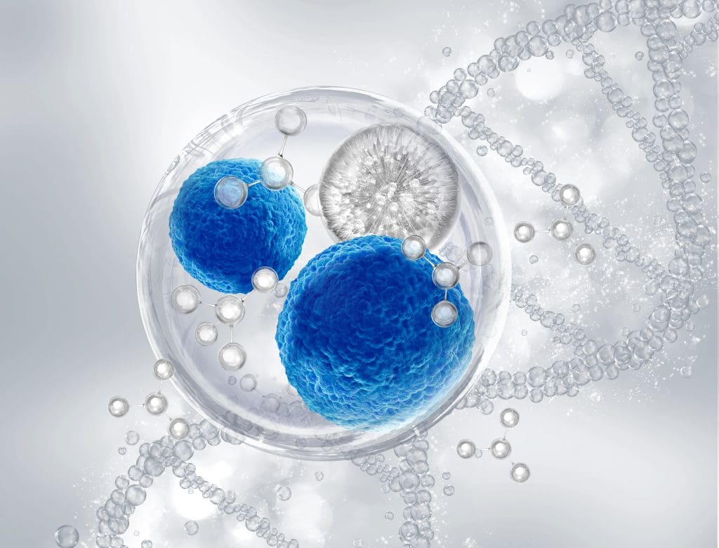 Allogeneic Stem Cell Transplant