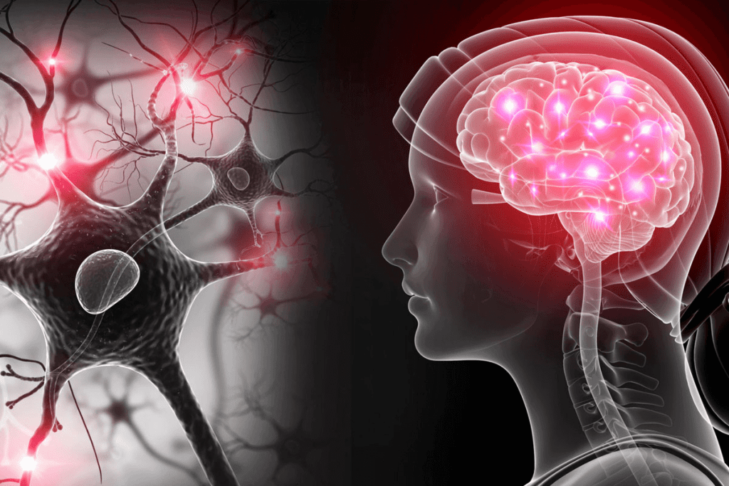 SPECT Brain Scan: Powerful Imaging for Neurological Disorders 1 SPECT Brain Scan: Powerful Imaging for Neurological Disorders