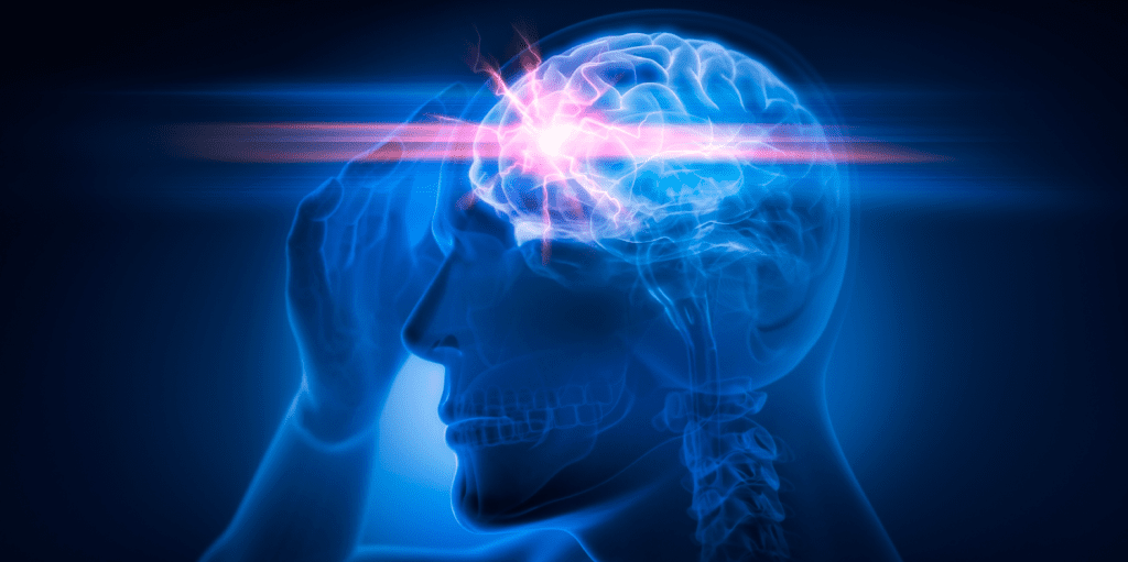 Brain Scan for Anxiety: Powerful Insights for Mental Health