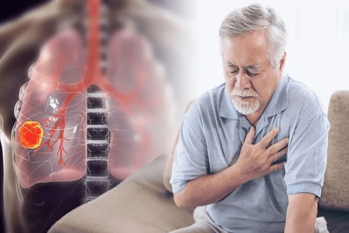 Difficult Cancers to Detect: Why Some Tumors Are Missed in Early Stages