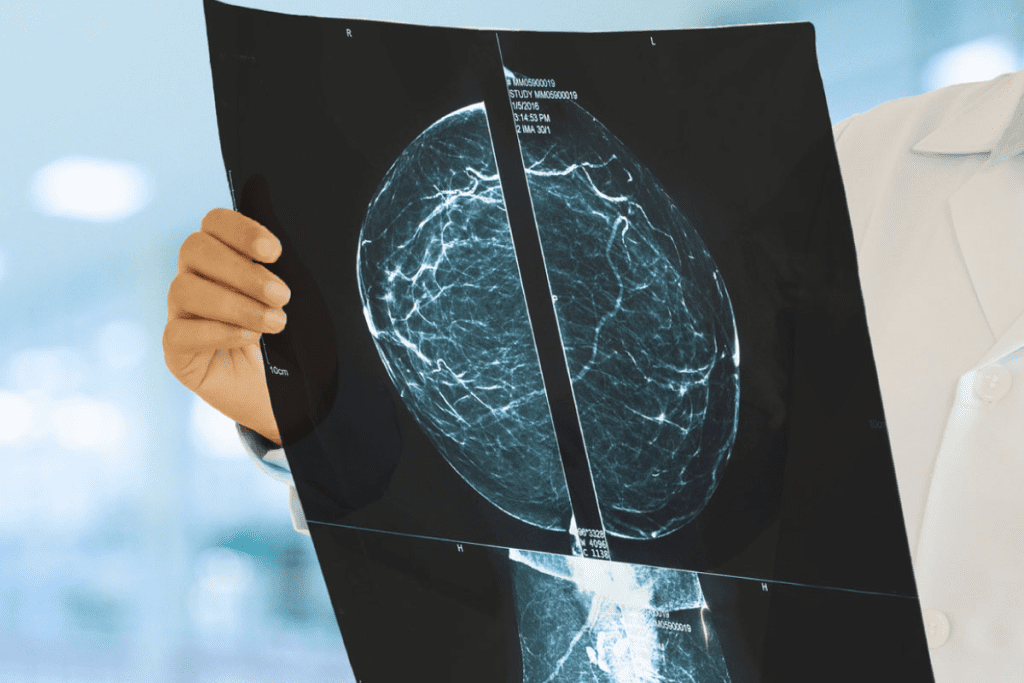 Cancers not detected PET scan