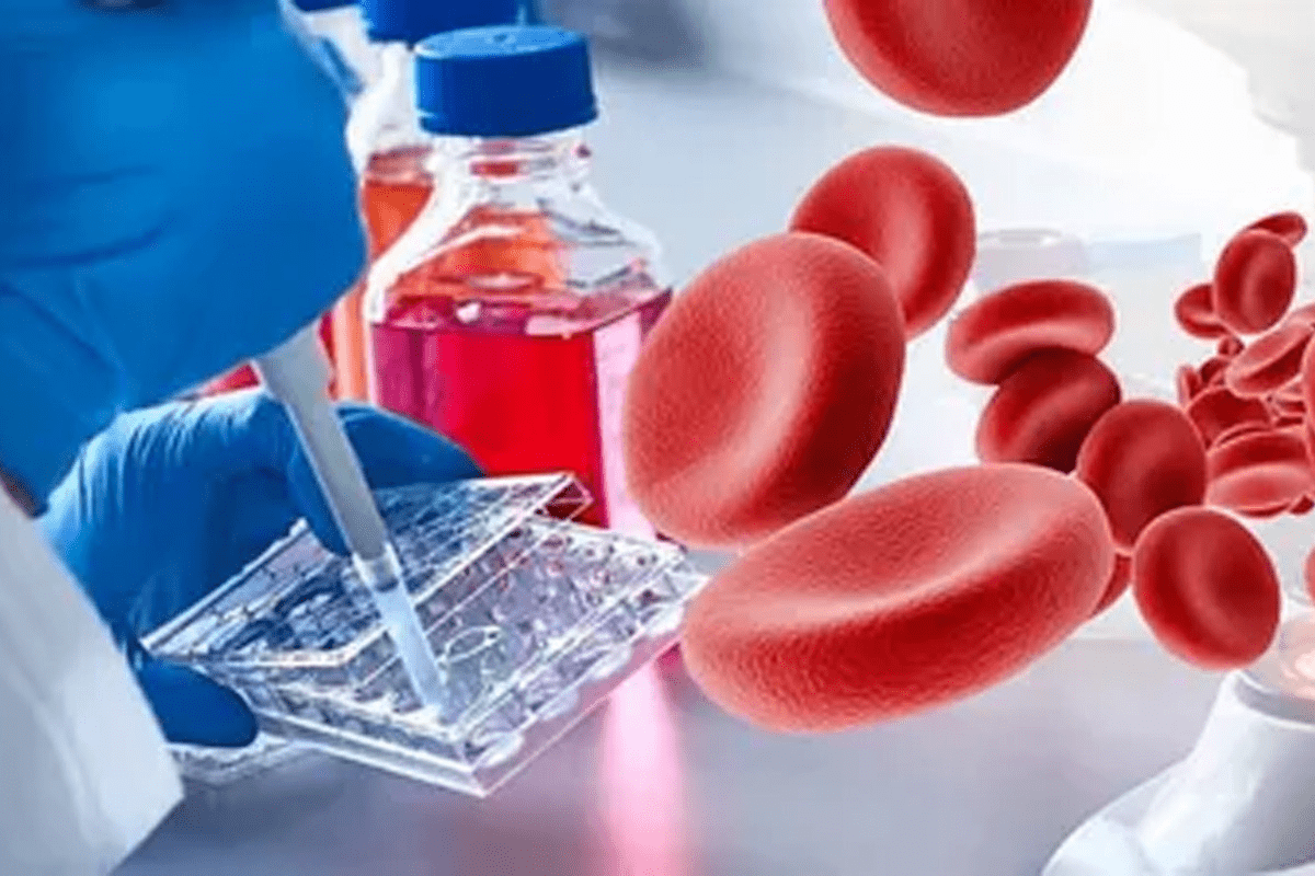 Haematology Hematology: Chemo's Impact on Blood Disorders