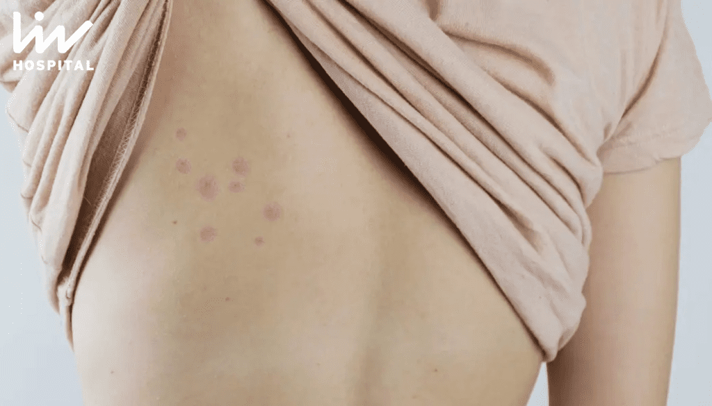 Downsides of Targeted Therapy