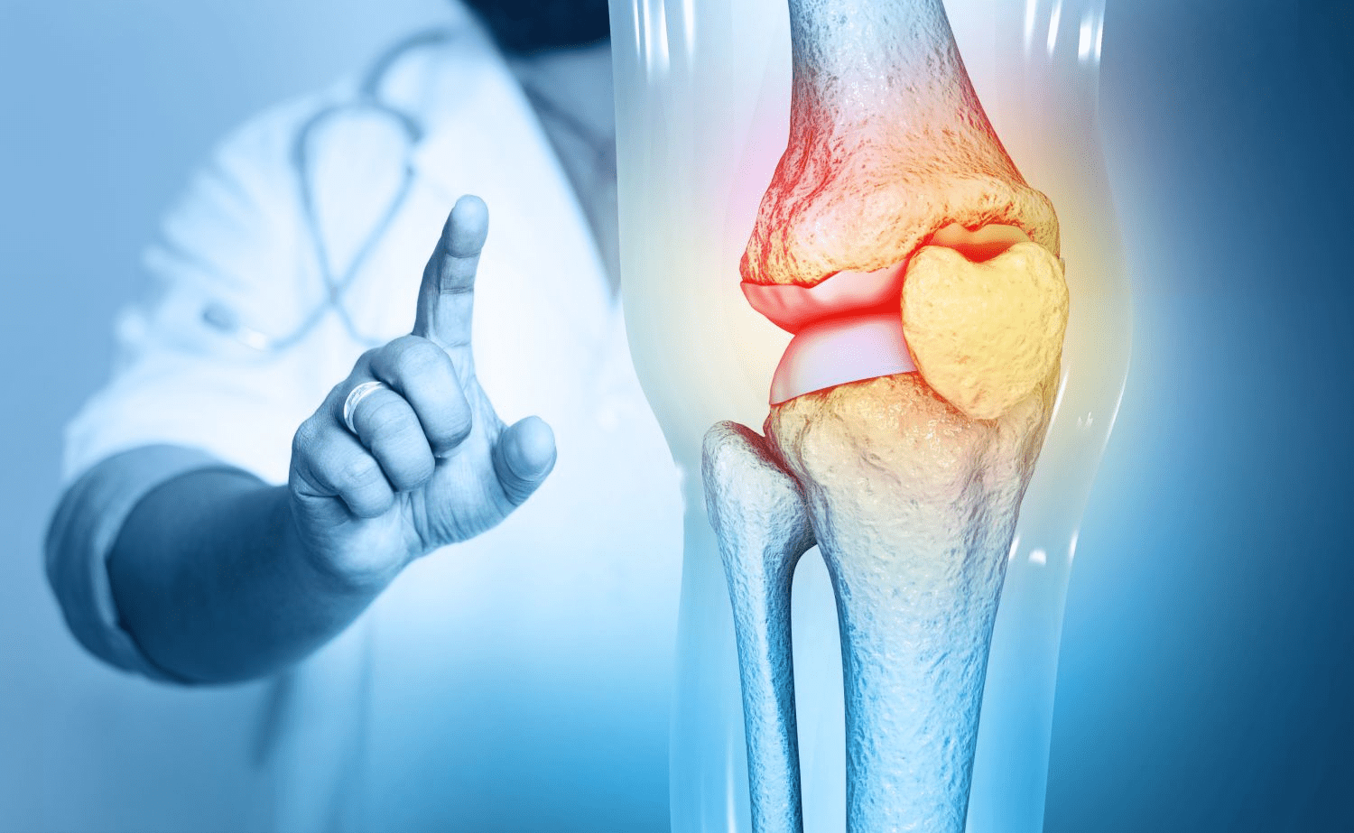 Osteoarthritis Scan: Powerful Tool for Joint Health Assessment
