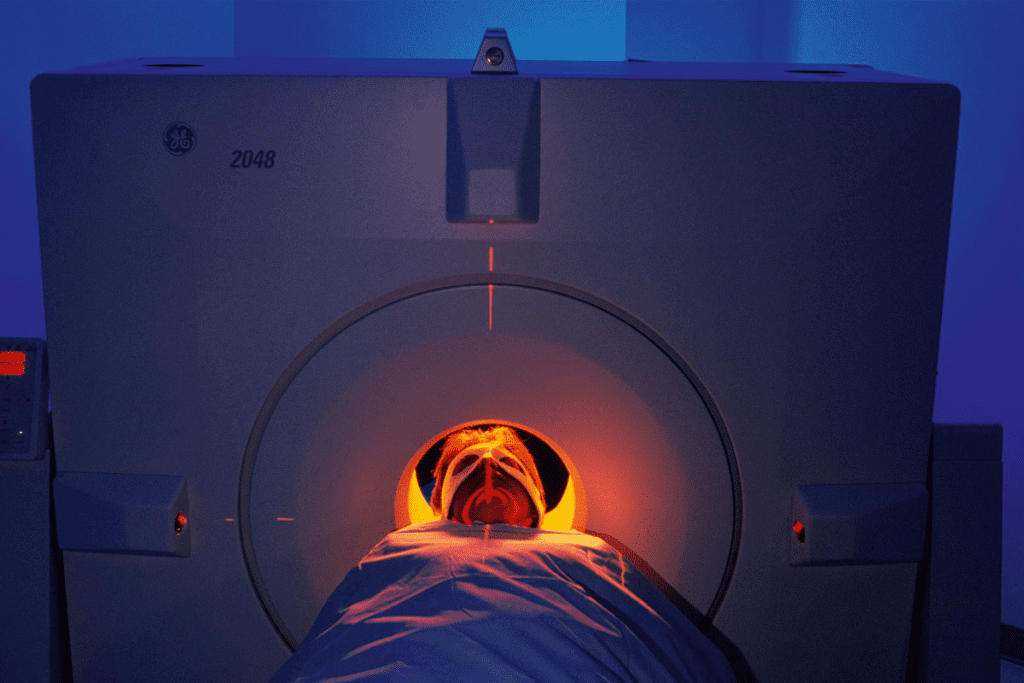 PET Scan Positive Results Next Steps: Powerful Guidance