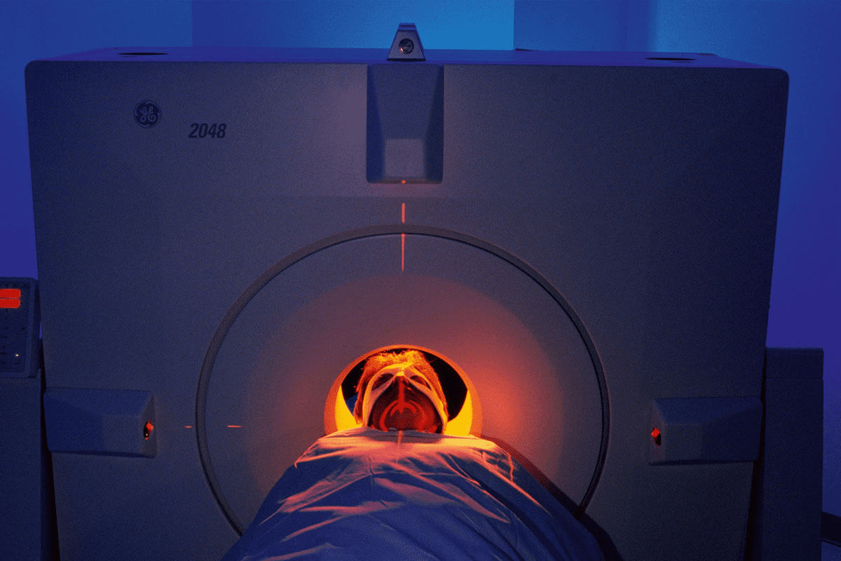 PET Scan Positive Results Next Steps: Powerful Guidance