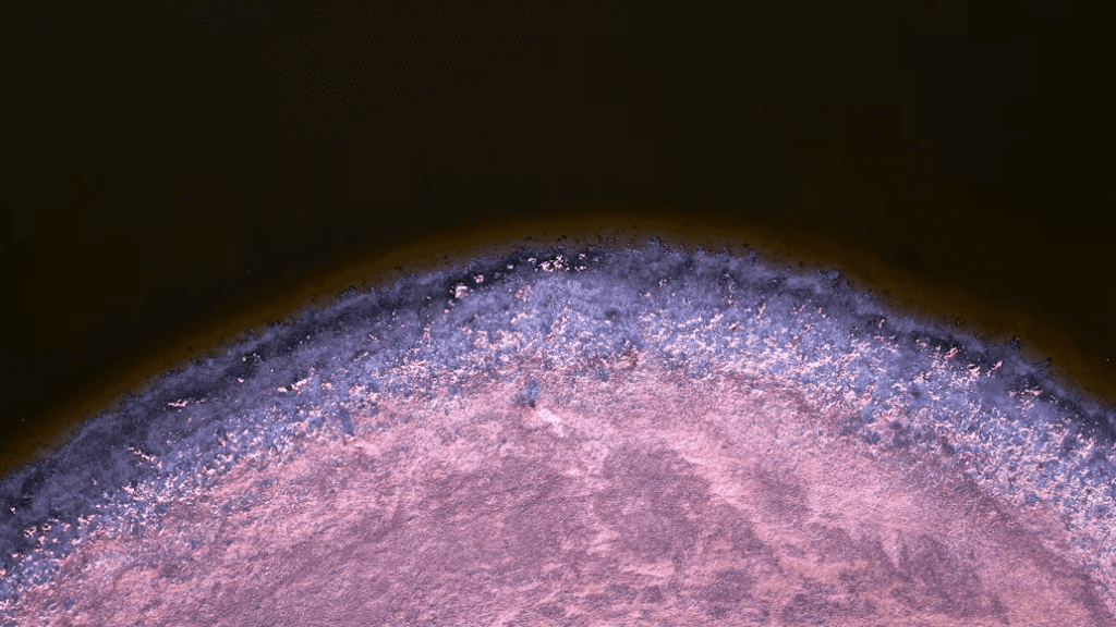 What Are Mesenchymal Stromal Cells?
