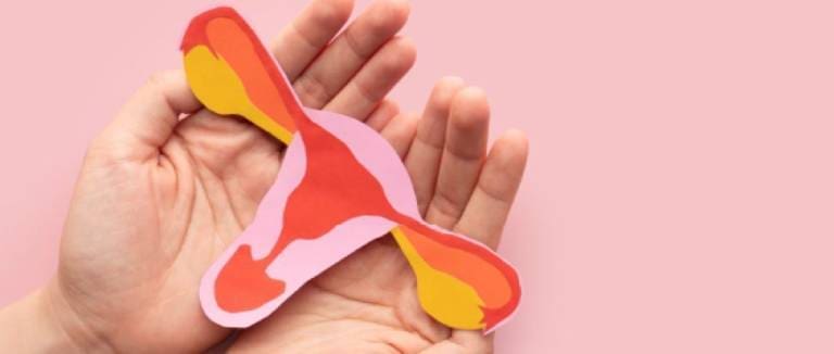 Pelvic Congestion Syndrome