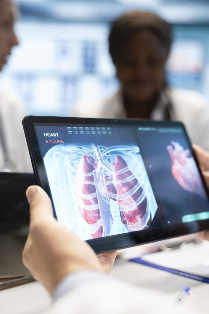 Can I Drive After a PET Scan? Guidelines for Your Trip Home 2 medics his staff meet discuss lungs radiography patient care strategy LIV Hospital