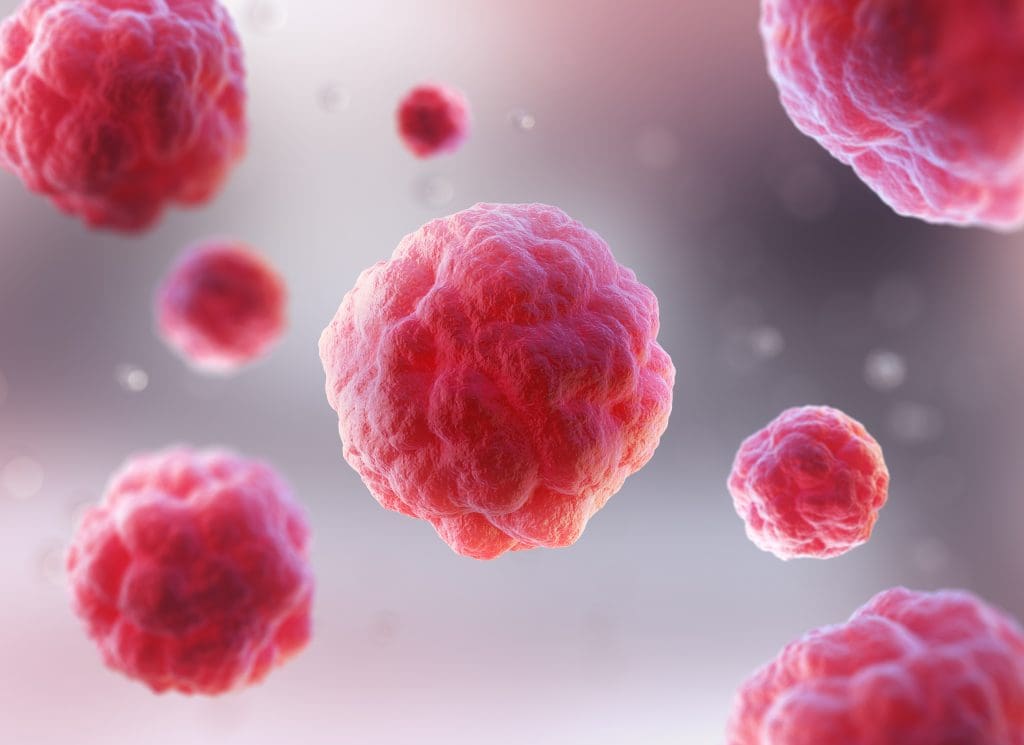 Can You Have a Normal Life After a Stem Cell Transplant? 1 can you have a normal life after a stem cell transplant