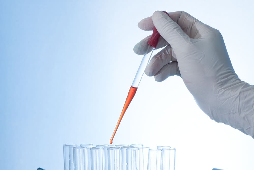 The Process of Autologous Stem Cell Extraction Explained 3 autologous stem cell transplantation