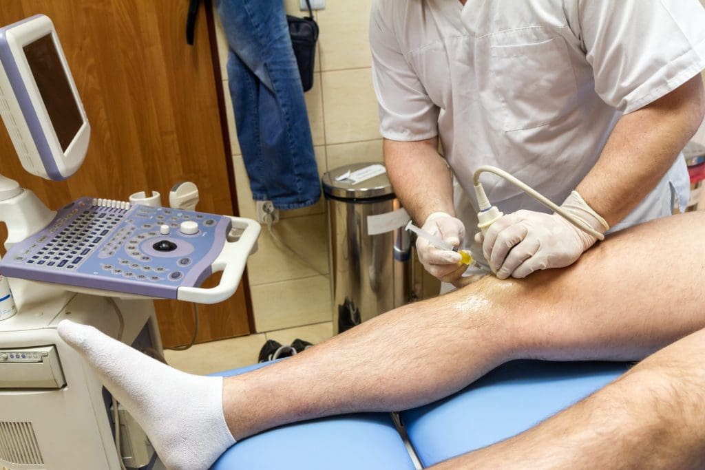 stem cell therapy for knees