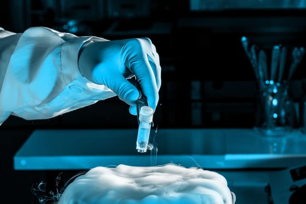 The Process of Autologous Stem Cell Extraction Explained 2 stem cell extraction