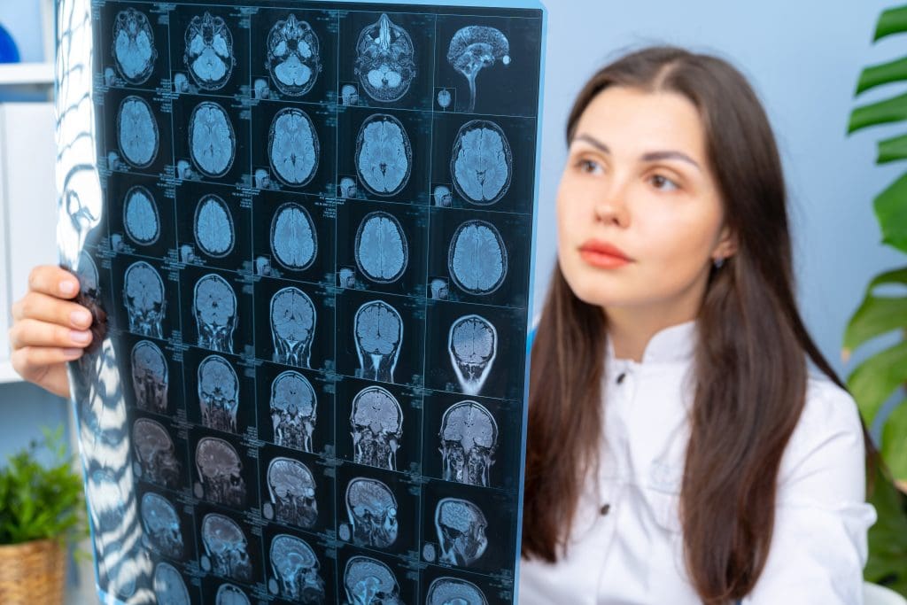 What's the Best Brain Scan for Mental Illness? A Guide to Imaging