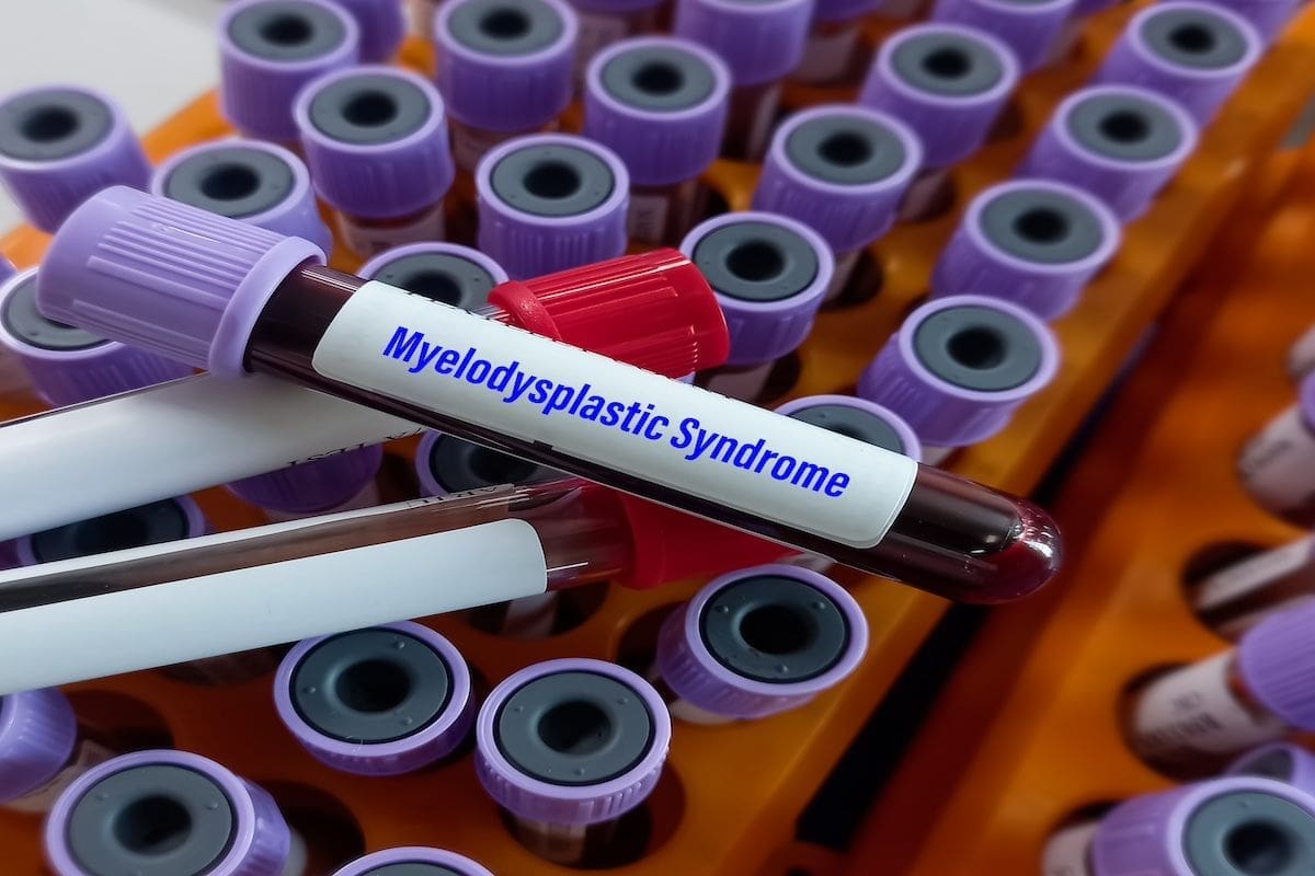 Myelodysplastic Syndrome: Dangerous Look-Alike