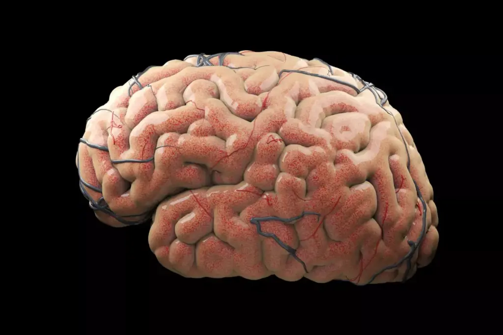 A close-up view of a human brain, with a visible, irregularly-shaped tumor protruding from the surface. The tumor appears ominous, with a mottled, discolored texture and an uneven, bulbous shape. The brain tissue around the tumor appears swollen and inflamed, with a subtle reddish hue. The lighting is harsh and directional, casting deep shadows that accentuate the tumor's textural details and the surrounding brain's distressed appearance. The image has a clinical, diagnostic feel, conveying the serious and concerning nature of the brain tumor condition.