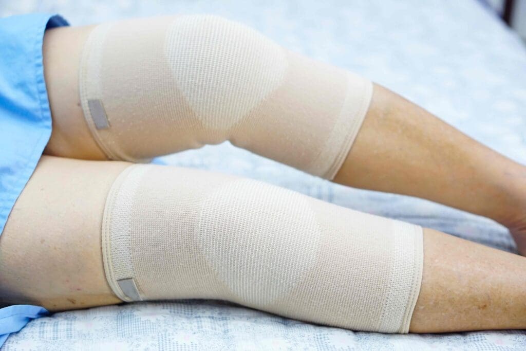 A close-up view of a human knee joint after a replacement surgery