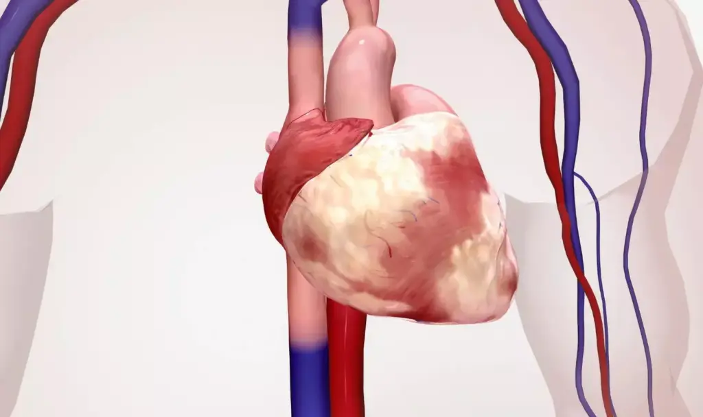 A detailed anatomical cross-section of a bicuspid aortic valve, showcasing its unique two-leaflet structure against a subtly blurred, clinical backdrop. The valve is rendered in high-definition, with precise depictions of the cusps, commissures, and surrounding aortic wall. Soft, directional lighting illuminates the intricate valve geometry, emphasizing its complex yet elegant form. The overall mood is one of scientific curiosity and medical precision, inviting the viewer to closely examine this critical cardiac structure. The perspective is slightly angled to provide optimal visibility, allowing for a comprehensive understanding of the bicuspid aortic valve's distinctive morphology.