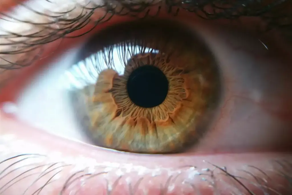 A detailed close-up view of a human eye, with the iris and pupil prominently visible. The eye appears strained and irritated, with a hazy, unfocused gaze. In the background, a faint outline of the brain is visible, with a glowing, ominous-looking mass disrupting its normal structure. The lighting is dramatic, with a combination of warm and cool tones, creating a sense of unease and tension. The lens is slightly wide-angled, drawing the viewer's attention to the unsettling connection between the eye and the underlying brain tumor. The overall mood is one of disquiet and the realization of the profound impact that brain cancer can have on a person's visual perception and daily life.