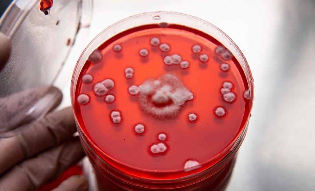 A detailed cross-section of the hematopoiesis process
