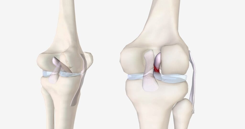 A detailed cross-section of the human knee joint