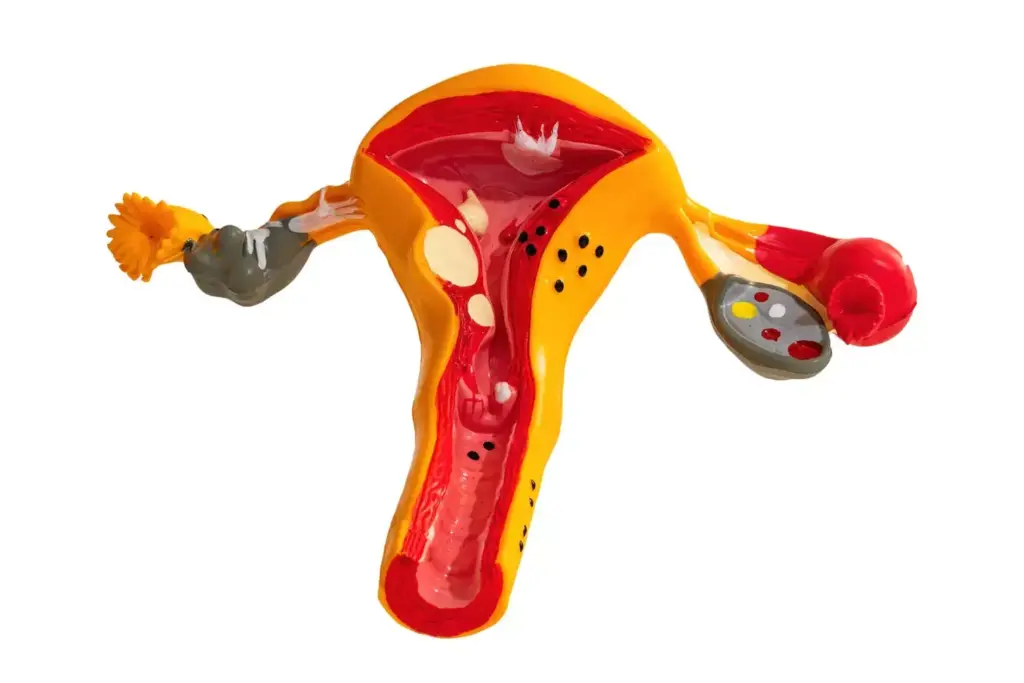 A detailed cross-section of the human uterus, showcasing the presence of multiple uterine fibroids. The fibroids are depicted as distinct, bulbous growths protruding from the uterine wall, rendered in realistic medical illustration style with accurate anatomical detail. The image is shot from an angle that provides a clear, unobstructed view of the fibroid formations, with soft, even lighting that highlights their textural qualities. The background is a muted, neutral tone, keeping the focus firmly on the uterine anatomy and the fibroids themselves. The overall mood is one of clinical precision and educational clarity, conveying the key visual information needed to understand this common gynecological condition.