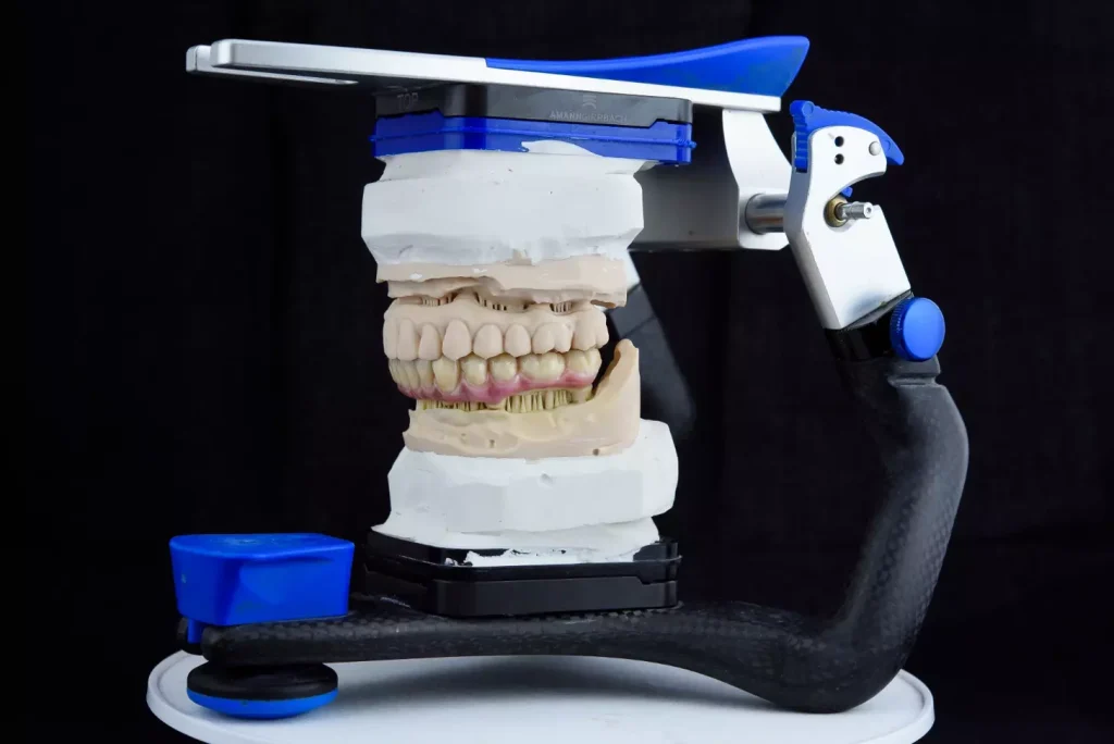 A detailed medical diagram illustrating the key classifications of dental implant bone density and quality. A clean, technical rendering with precise anatomical accuracy, lit by bright, natural light from an overhead angle. The foreground depicts the four main bone types - Type I, II, III, and IV - in cross-section, with clear labels and explanatory details. The middle ground shows an overview of the jawbone structure, highlighting the differences in bone density. The background is a neutral, subtly textured surface providing context without distractions.
