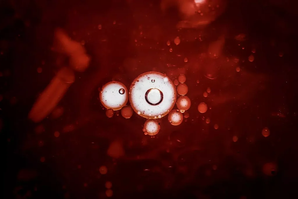 A detailed microscopic view of acute myeloid leukemia cells. Rendered in a realistic, high-resolution medical illustration style. The foreground features an up-close examination of the abnormal, rapidly-proliferating myeloid cells, with their distinctive irregular shapes, enlarged nuclei, and varied color tones. The middle ground presents a cross-section of bone marrow, with the leukemic cells invading the normally orderly hematopoietic environment. The background shows a softly blurred anatomical context, suggesting the systemic nature of the disease. Crisp lighting from an angle highlights the textural details of the cells. Conveys the complex, aggressive nature of this blood cancer in a clinical yet compelling manner.