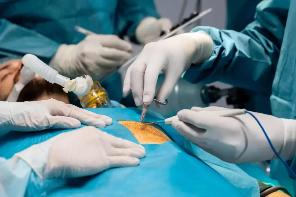 A high-angle view of a detailed surgical scene depicting a revision total knee arthroplasty procedure. The foreground features the exposed surgical site, with the surgeon's hands manipulating the knee joint and implant components. The middle ground showcases various specialized medical instruments and tools arranged neatly on a sterile surgical tray. The background is dimly lit, with the surgical lights casting a warm, focused glow on the scene, creating an atmosphere of clinical precision and expertise. The image conveys the complexity and technical nature of this intricate orthopedic surgery.