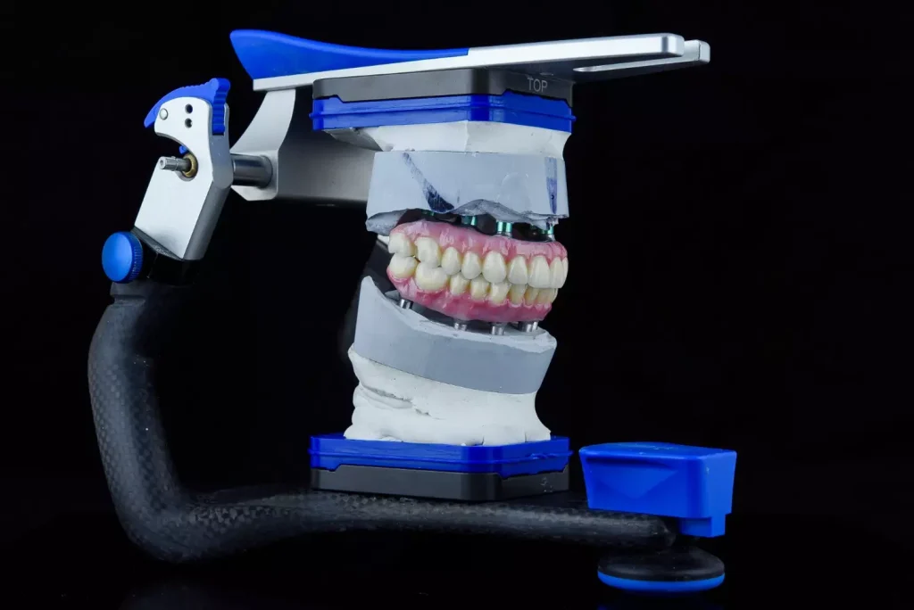 A highly detailed, medically accurate illustration of a dental implant procedure featuring bone grafting. The foreground shows the open surgical site with the jawbone and implant fixture, rendered in precise anatomical detail. The middle ground displays the surgical instruments and techniques used for bone augmentation, such as bone graft material, collagen membranes, and sutures. The background depicts a sterile, well-lit operating room environment with medical equipment. The lighting is bright and directional, casting subtle shadows that accentuate the contours of the anatomy. The overall mood is one of clinical precision, highlighting the technical expertise required for this delicate procedure.