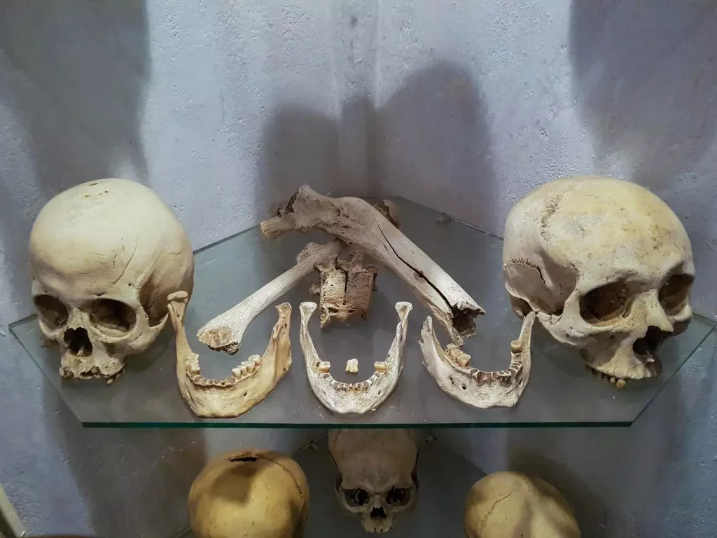 A medical laboratory filled with rows of donated cadaver bones, neatly arranged on metal examination tables under bright, sterile lighting. The bones are of various sizes and shapes, some partially reassembled skeletons, others individual femurs, tibias, and vertebrae. The atmosphere is clinical, with a sense of reverence for the human remains that will be used for medical advancements. In the foreground, a gloved hand gently holds a femur, examining its structure and integrity. The middle ground showcases the organized chaos of the donation process, while the background fades into the white, pristine walls of the lab.