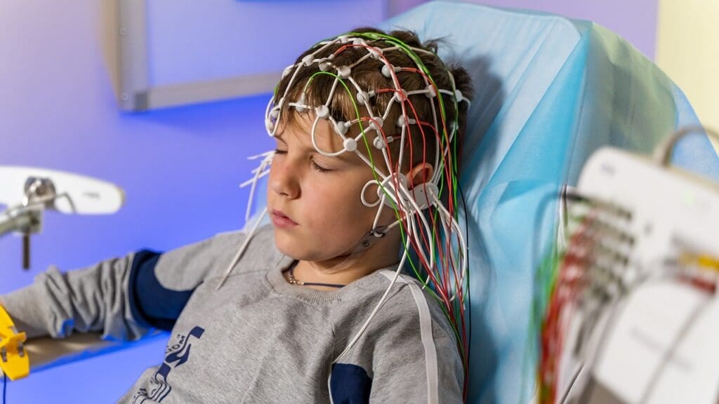 Acute Disseminated Encephalomyelitis Symptoms 