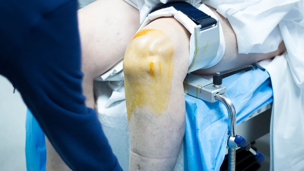 Arthroscopic Knee Surgery