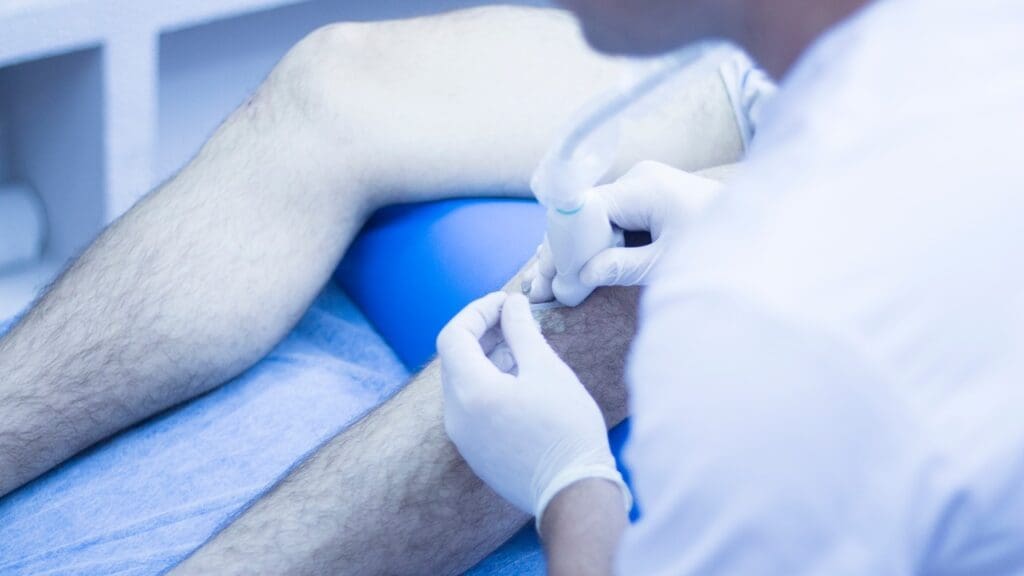 Arthroscopic Knee Surgery
