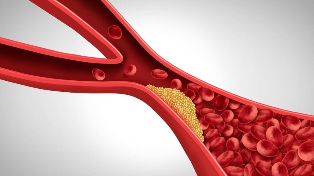 Basic Anatomy of Blood Vessels