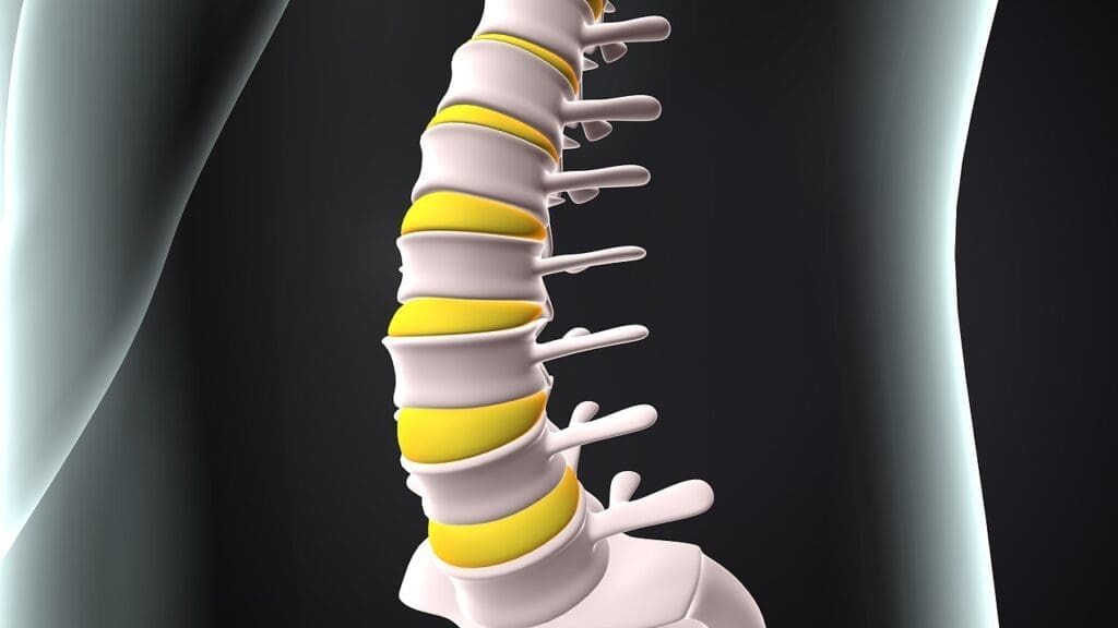 Bulged Disc in the Lower Back