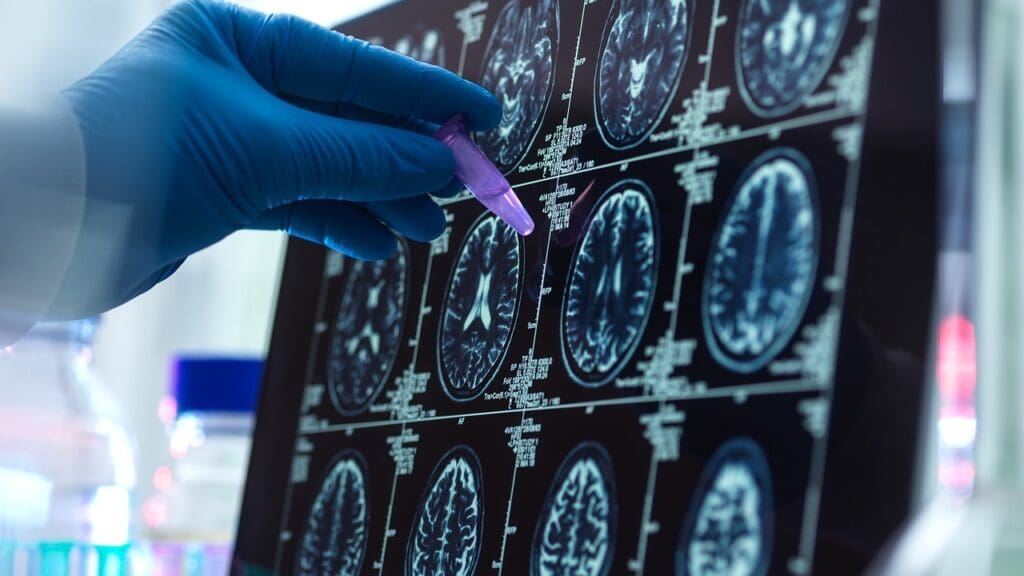 CT scan for brain injury