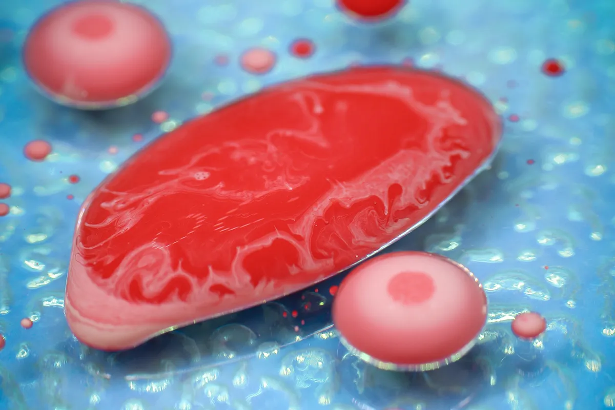 D5 1/2 Normal Saline: Crucial IV Fluid Choice