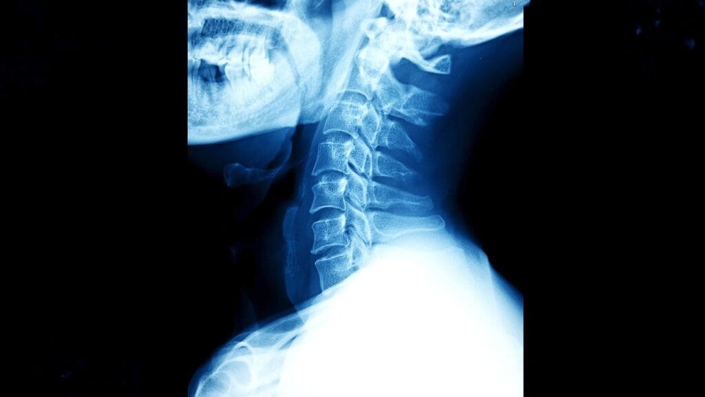 Cervical spine anatomy