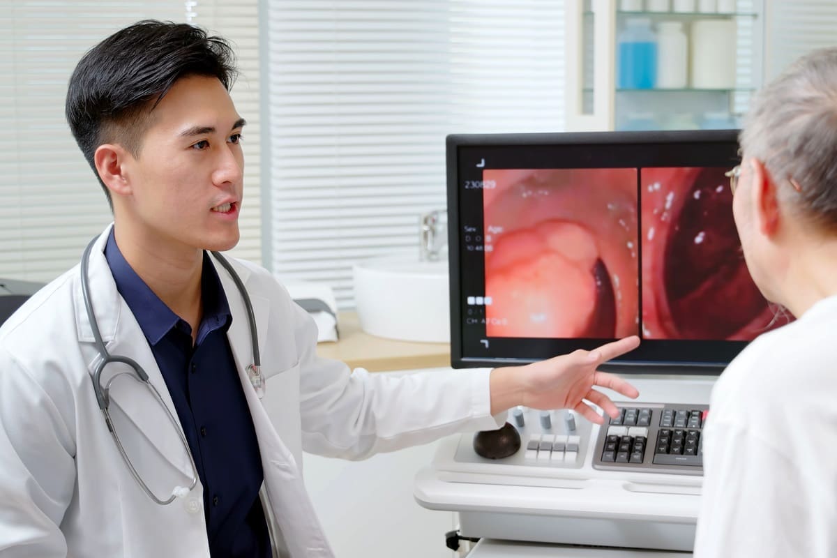 Colon Cancer Survival Rate Long-Term Outlook