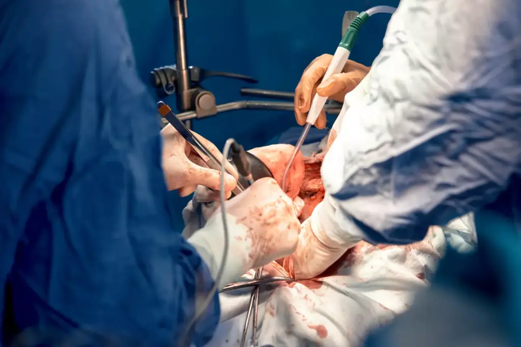 Coronary Artery Bypass Graft Indications