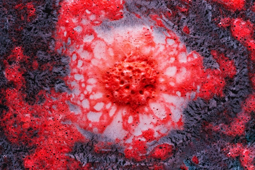 Detailed close-up of squamous cell carcinoma, a type of skin cancer characterized by abnormal growth of squamous cells. The malignant lesion appears as a rough, scaly, red patch or nodule with irregular borders. Capture the texture, discoloration, and irregular shape under warm, natural lighting from the side to highlight the uneven surface and depth. Render the skin with high resolution and clarity, emphasizing the cellular-level detail to convey the medical and diagnostic nature of the subject.