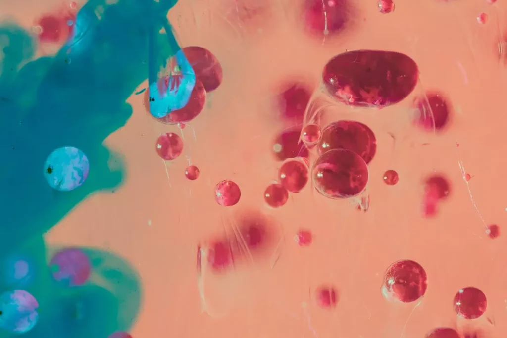 Detailed microscopic examination of abnormal blood cells indicative of acute myeloid leukemia. Foreground displays high-magnification view of malignant myeloblasts with irregular nuclei and prominent nucleoli, stained with Wright-Giemsa. Midground shows a bone marrow aspirate smear with a proliferation of immature myeloid precursors. Background depicts a hematology analyzer displaying diagnostic results for elevated white blood cell count, decreased hemoglobin, and thrombocytopenia. Lighting is clinical and scientific, captured with a high-resolution medical microscope camera. The overall mood is one of professional medical analysis and diagnosis of this aggressive form of blood cancer.