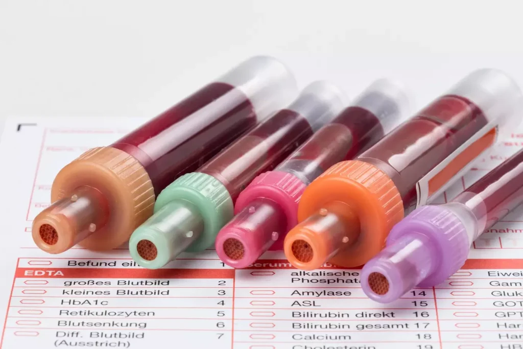 Different Types of Blood Transfusions