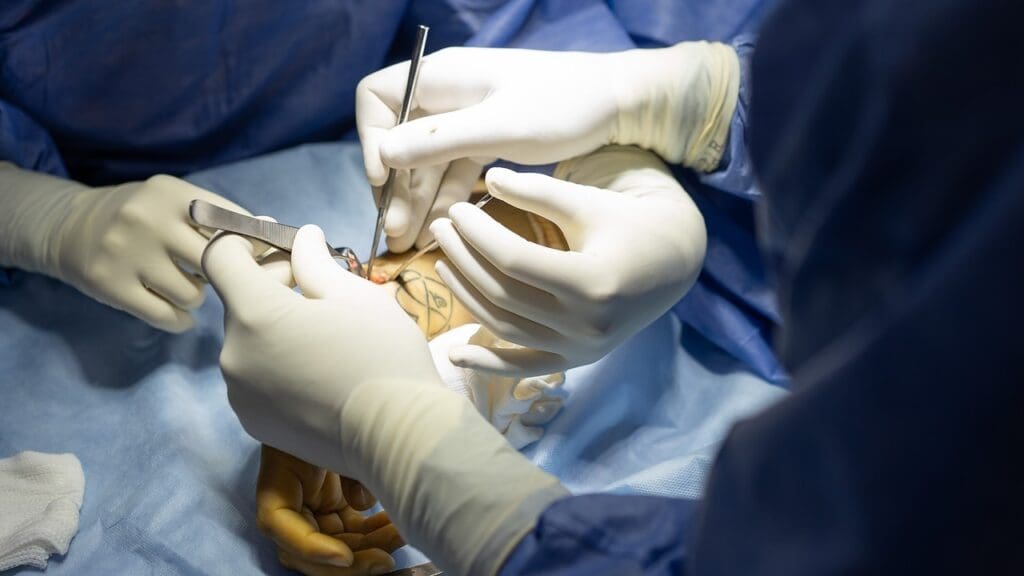 Different Types of Hip Surgery