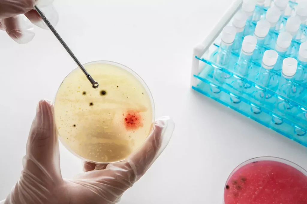 HLA matching for allogeneic stem cell transplant