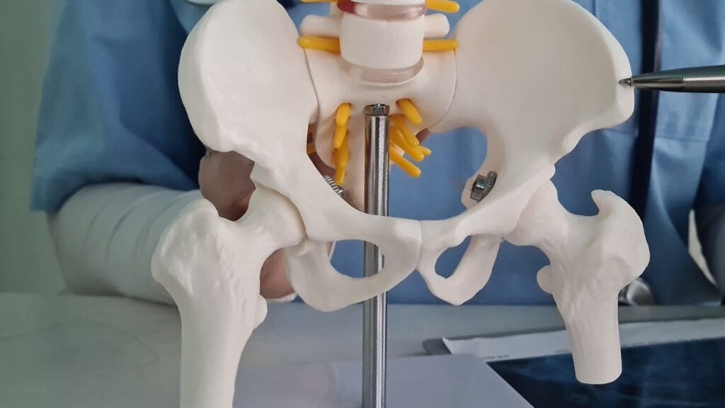 Hip Implant Parts